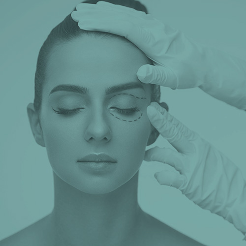 Blefaroplastia PlasticSkin