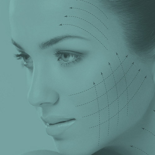 Hilos PDO PlasticSkin