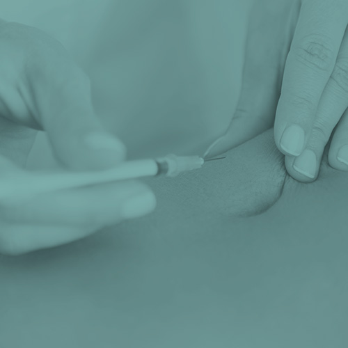 PRP Plasma rico en plaquetas PlasticSkin